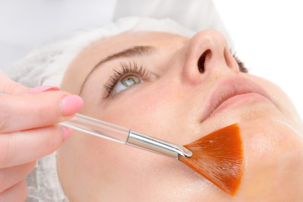 CHEMICAL-PEEL.jpg